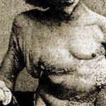 Top 10 al celor mai ciudate afectiuni