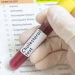 Colesterol ridicat: simptome si cauze despre care ar trebui sa stii