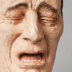 Disestezia: ce este, cauze si tipuri