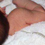 Hipertricoza sau sindromul varcolacului la copii